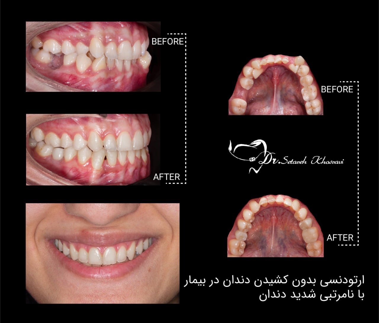 ارتودنسی  1