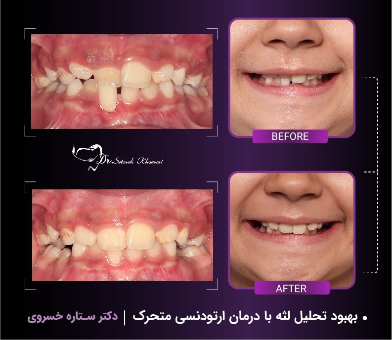 نمونه ارتو 3