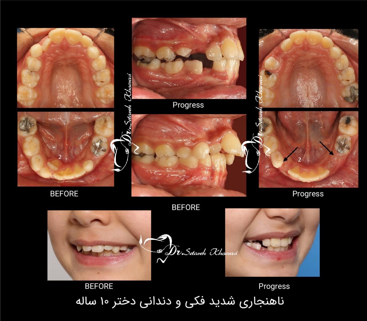 نمونه ارتو 2