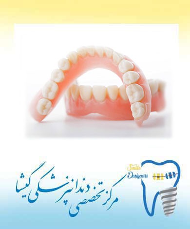 فرایند درمانی دندان مصنوعی (پروتز کامل) توسط متخصص پروتزهای دندانی در تهران