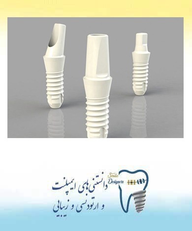 فواید و مزیتهای ایمپلنت  دندان زیرکونیا