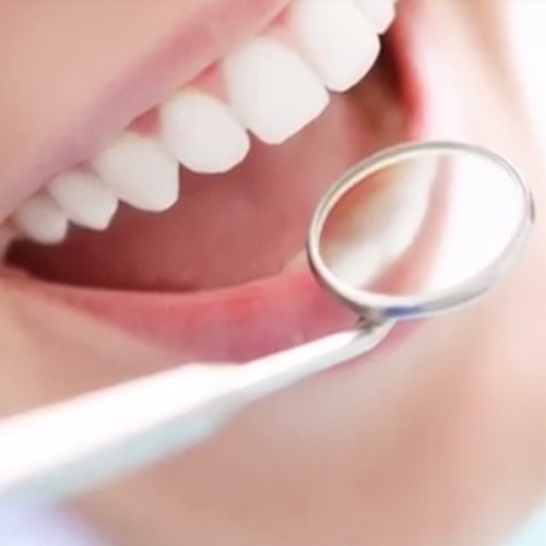 اشتباهات رایج در لمینیت دندان