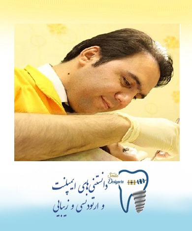 ویژگی‌های بهترین متخصص ایمپلنت دندان در تهران
