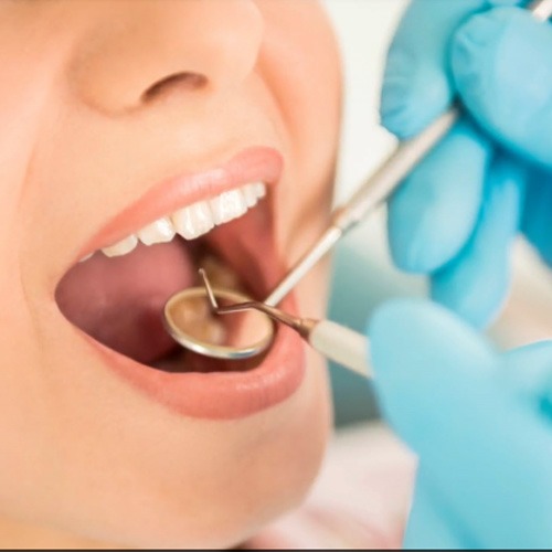 معیار های بهترین دندانپزشک تهران