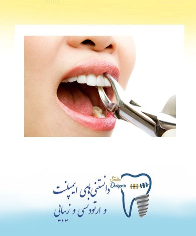 دلایل کشیدن دندان چیست؟