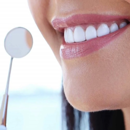 عوامل تعیین کننده هزینه های درمان دندانپزشکی