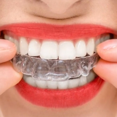 ارتودنسی ثابت دندان (متخصص ارتودنسی خوب)